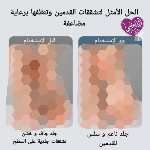 ⁦جهاز حفاف القدمين⁩ - الصورة ⁦4⁩
